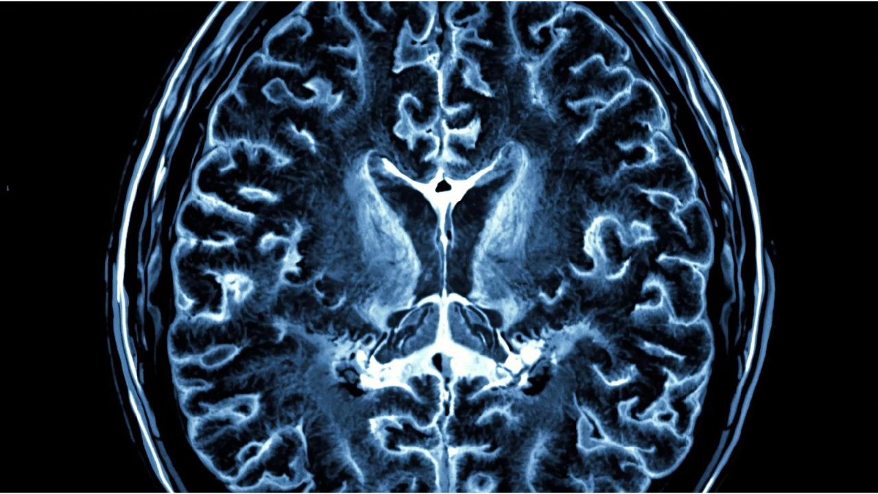 Human Connectome Project